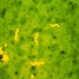 Lyme Disease